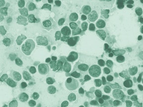 Ematologia e Coagulazione